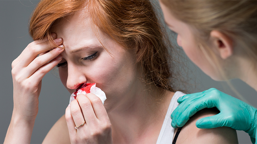 Bloody nose in adults causes