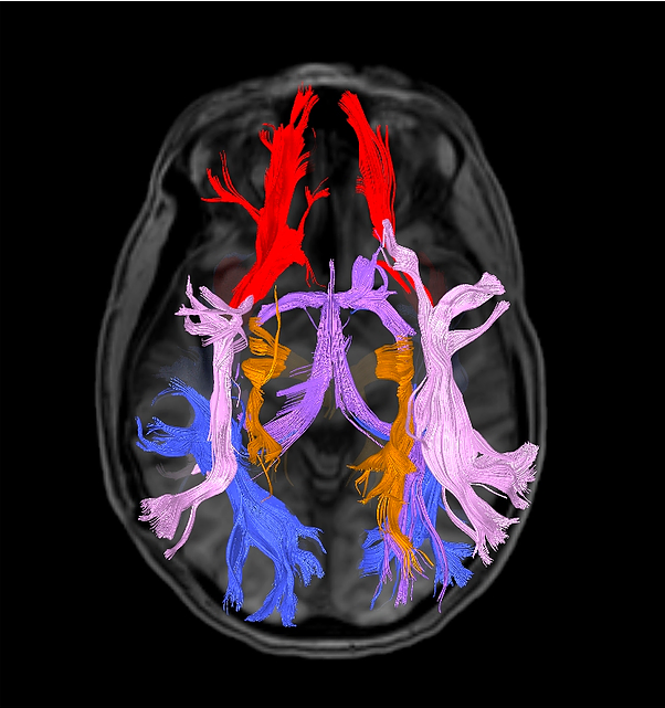 Conectividade Cerebral