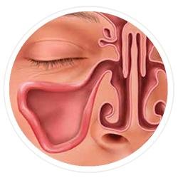 Cleared Sinuses