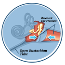 ETD Treatment, Relieve
