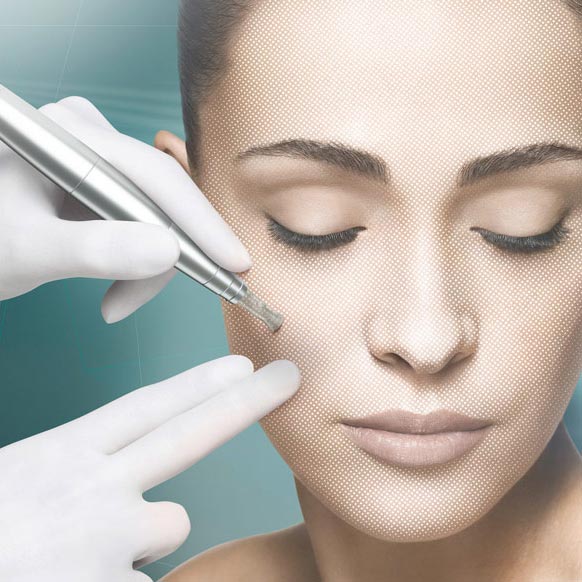 Babor MICRO NEEDLING - Wirkstoffe kommen durch MICRO NEEDLING dort an, wo sie sich am besten entfalten können. Micro needling ist eine nicht- invasive anti-aging Behandlung