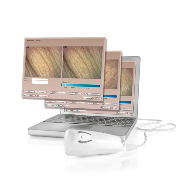 Hautanalyse bei Easy Beauty ermöglicht es Ihnen Ihre Haut besser kennenzulernen und die beste und schnellste Behandlungen für Ihre Hautprobleme zu finden.
