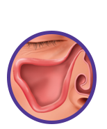 Relieve - sinus drainage is restored