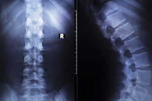orthopedic spine surgeon