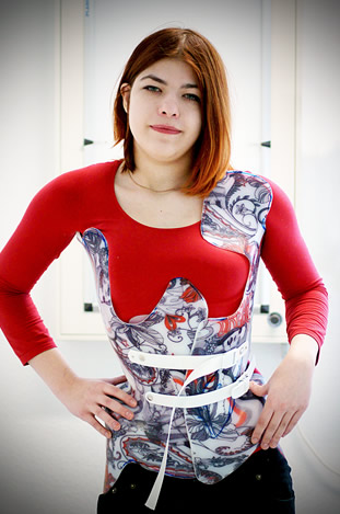 nonsurgical scoliosis treatment