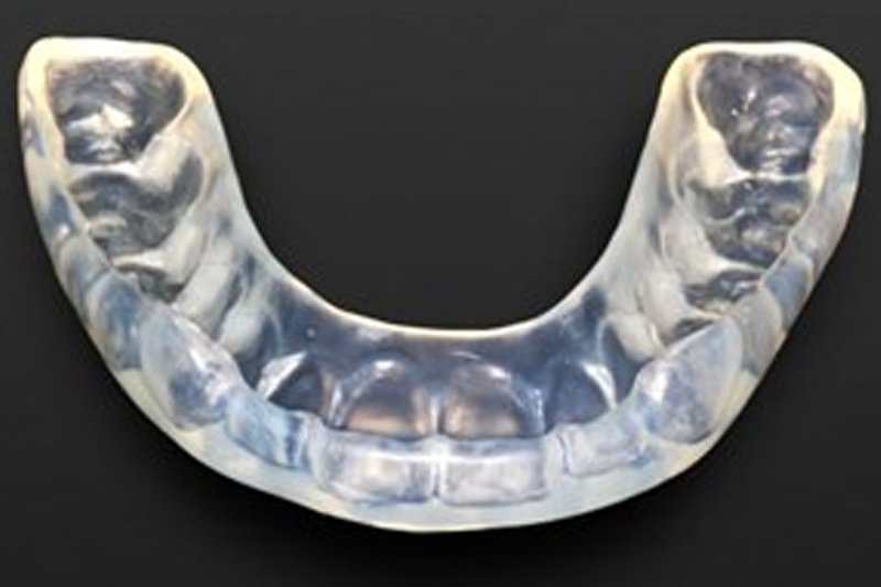 Bruxism / Occlusal Splints